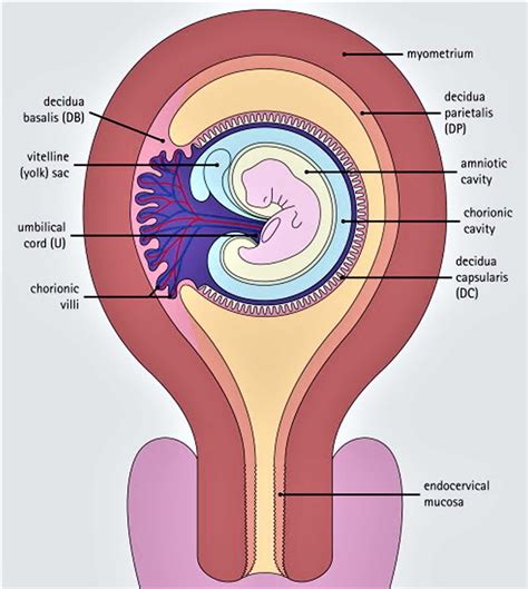 Abortion of <strong>decidual cast</strong> complicating pregnancy in uterus didelphys. . Decidual cast postpartum